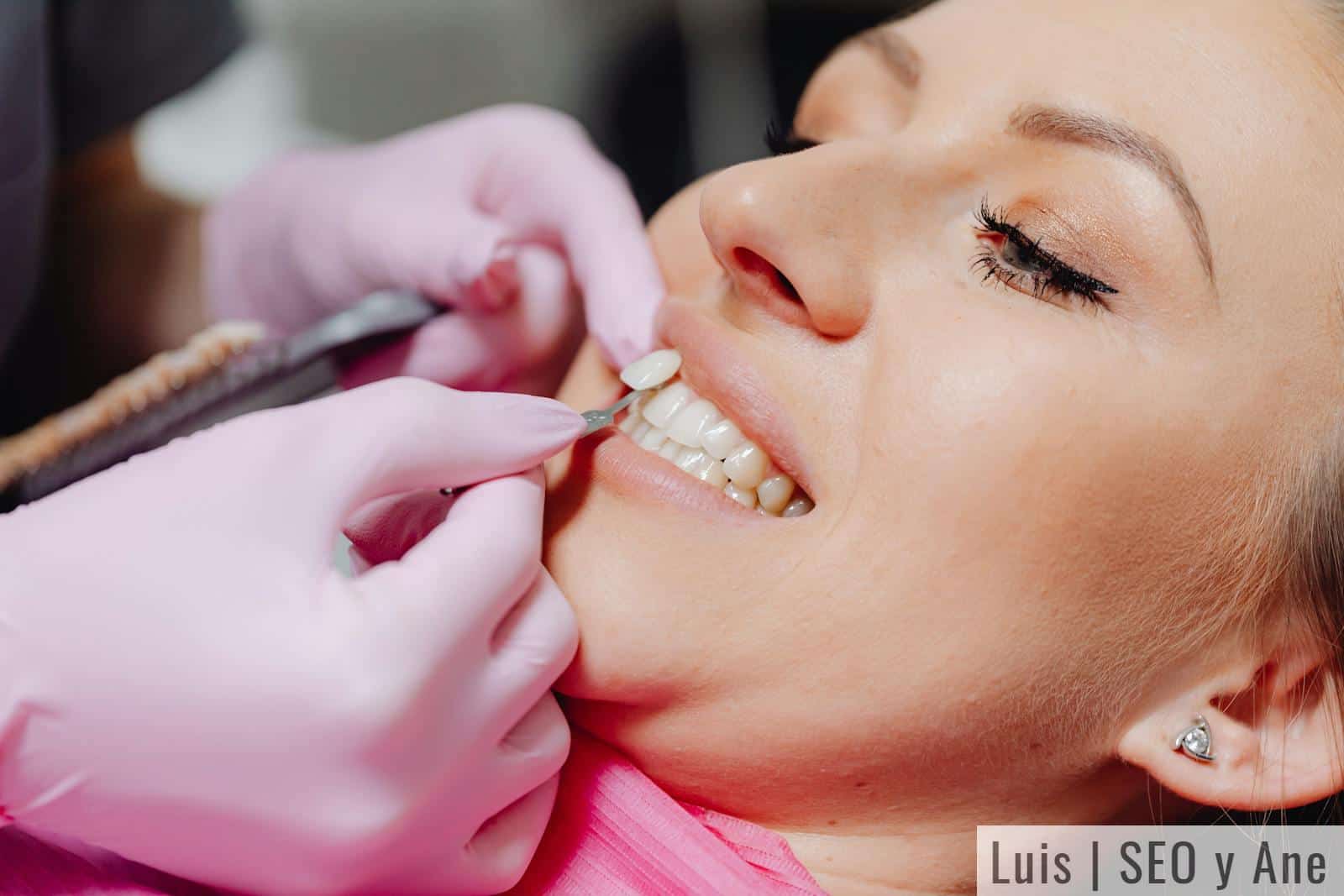 A close-up of a woman receiving dental veneers, showcasing detail and precision.